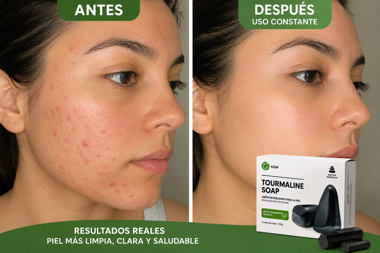 Jabón Natural De Turmalina Control Acné Y Limpieza Pack 2