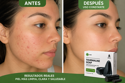 Jabón Natural De Turmalina Control Acné Y Limpieza Pack 2